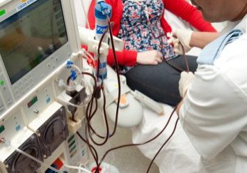 Female receiving dialysis in hospital Female receiving dialysis in hospital