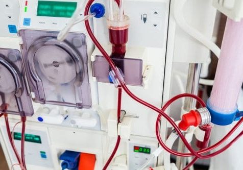 Dialysis device with rotating pumps. Dialysis device with rotating pumps. Closeup view.