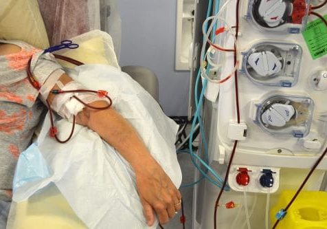On-dialysis Person on dialysis