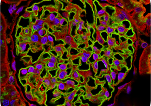 glomerulus A detailed image of a glomerulus